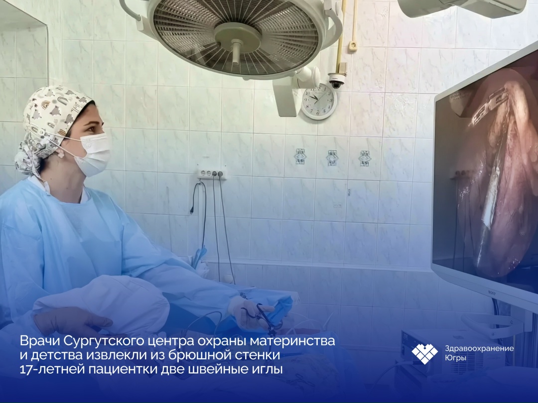 Сургутские врачи извлекли из брюшной стенки 17-летней пациентки две швейные иглы Девушку направили в